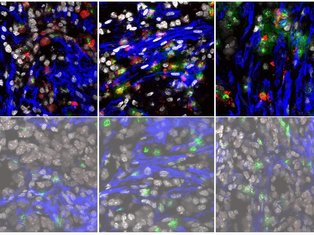 TME confocal image